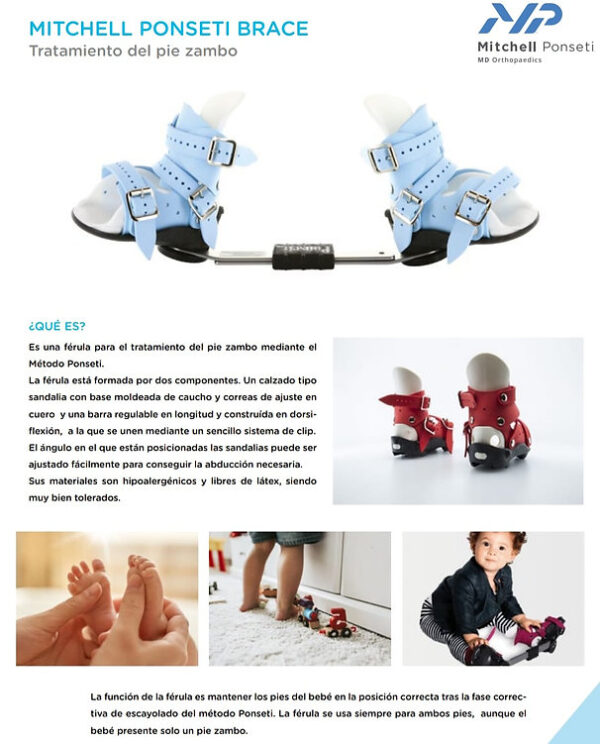 Barra para Ortesis Mitchell Ponseti® para el tratamiento del pie zambo - Imagen 2