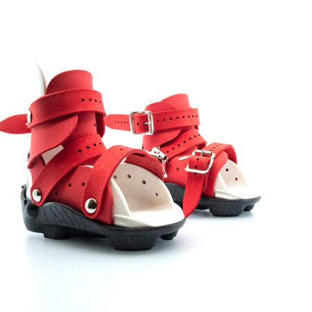 Ortesis Mitchell Ponseti® custom para el tratamiento del pie zambo