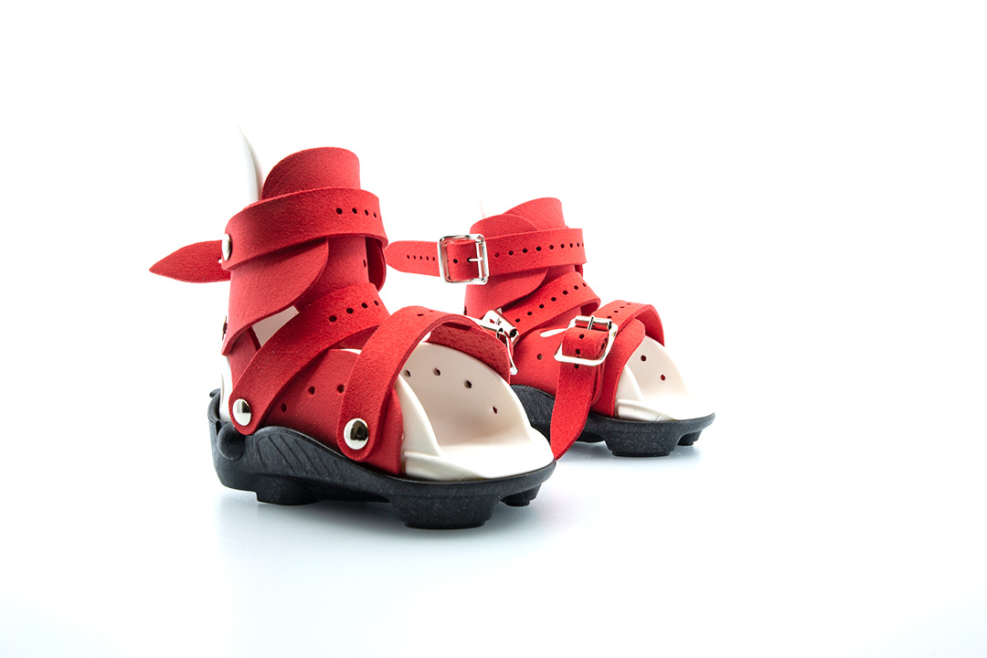 Ortesis Mitchell Ponseti® custom para el tratamiento del pie zambo